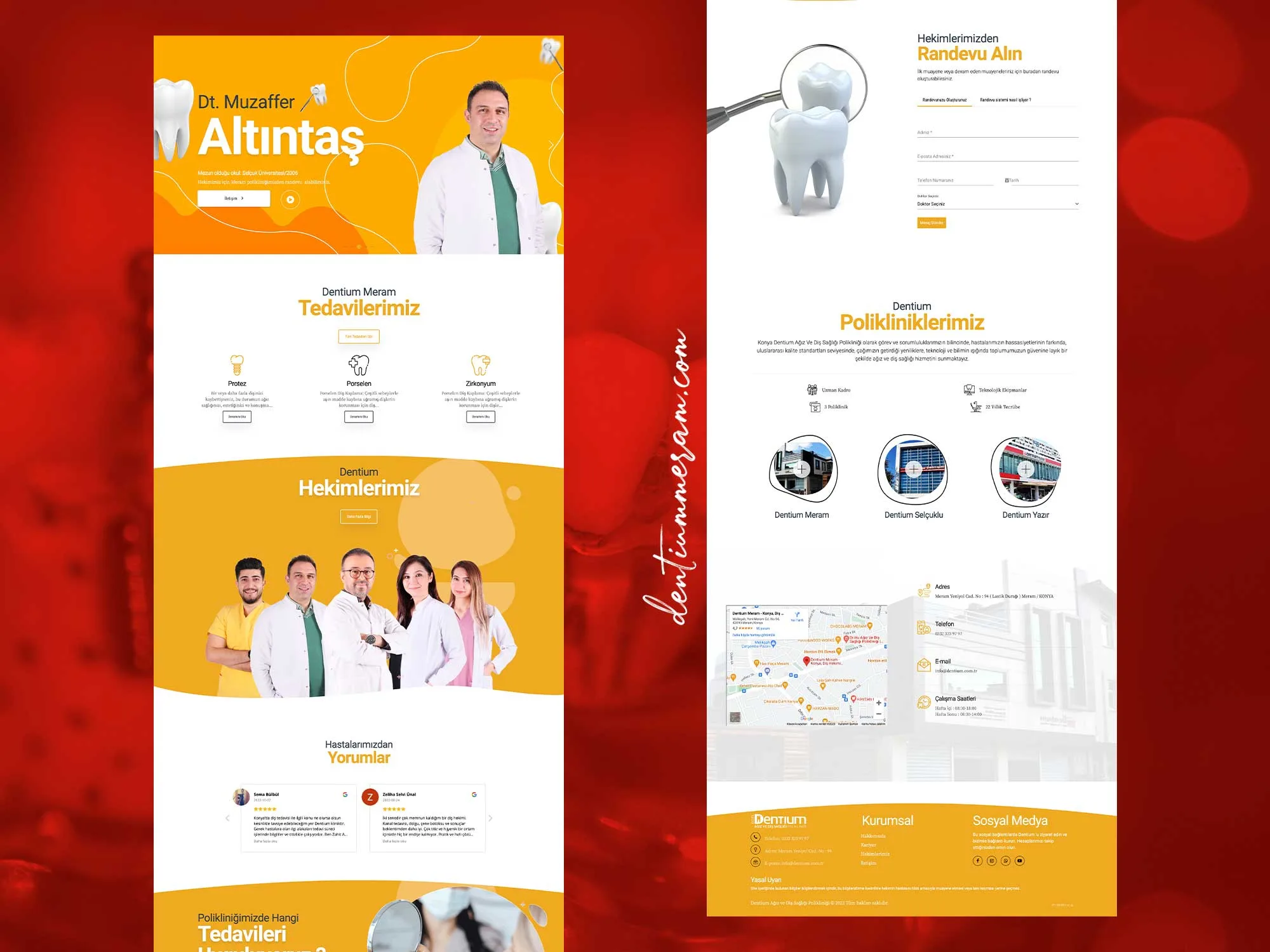 dentium-sunum-14 dentium-sunum-14